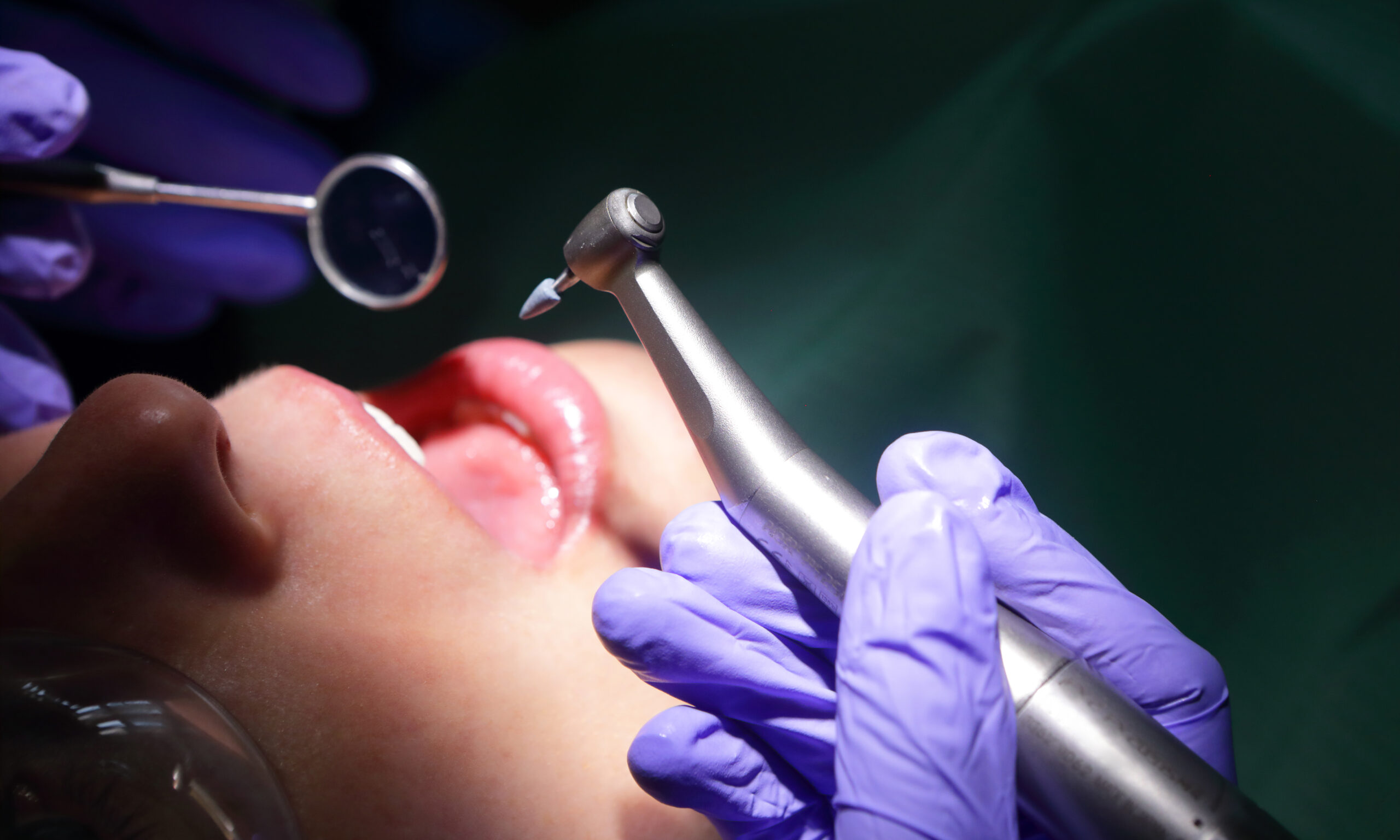 Bite the Bullet: A Guide to Facing Dental Anxiety