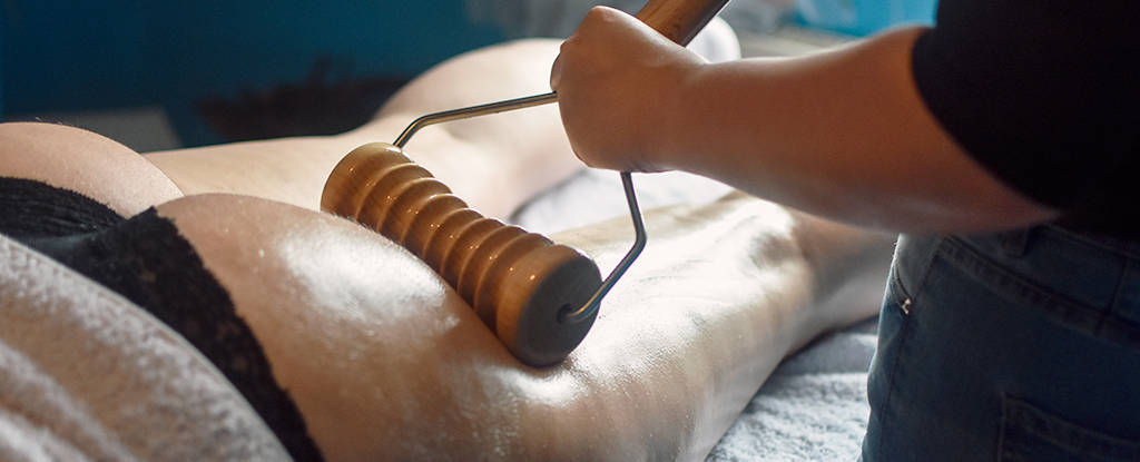 Do Anti-Cellulite Treatments Work? Expert Says We're Asking The Wrong Question.