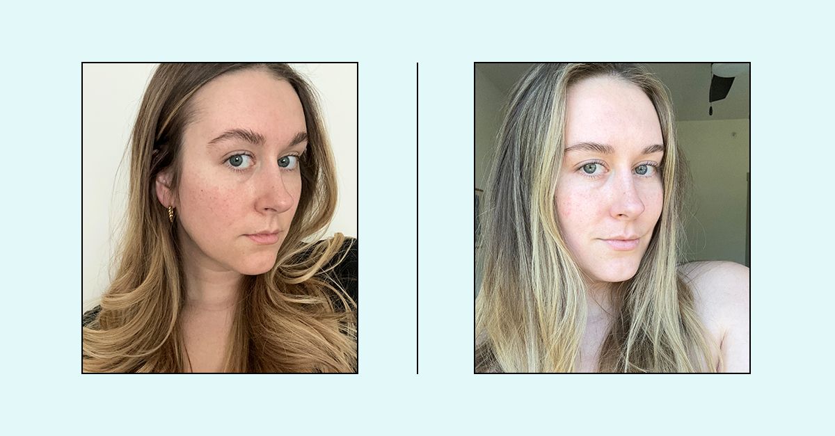 This High-Tech Device Claims to Be 100 Times More Powerful Than an LED Mask, so I Tried It