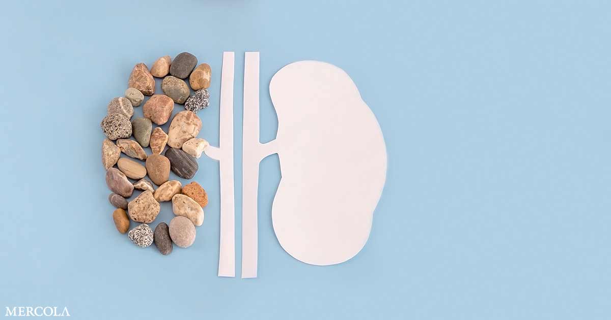 Could Antibiotics Increase Your Risk for Kidney Stones?