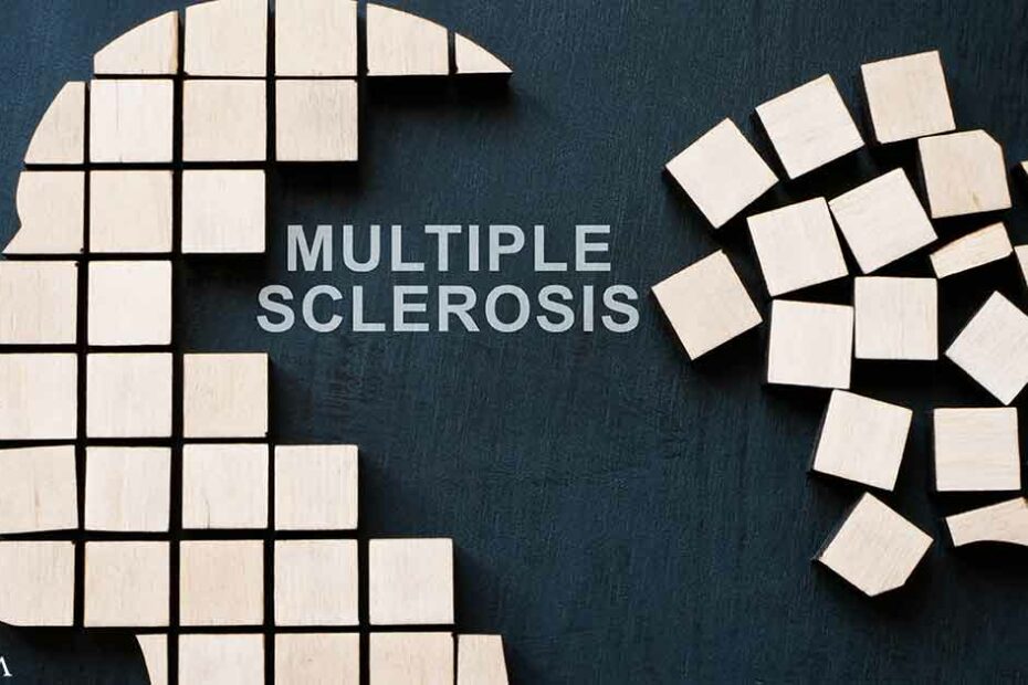 Could Your Gut Influence Your Risk of Multiple Sclerosis?