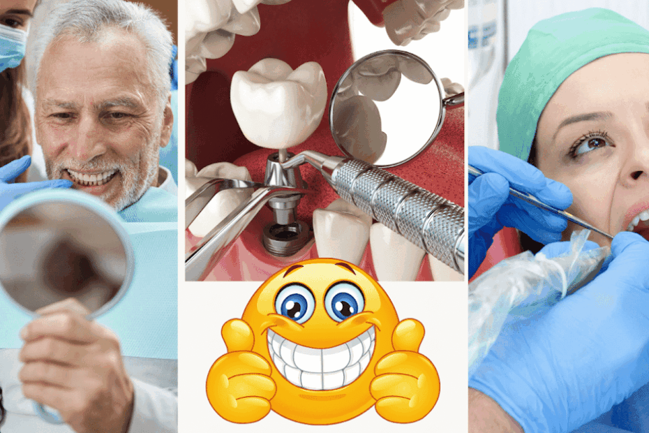 All On 4 Implants: Before, During, And After Care