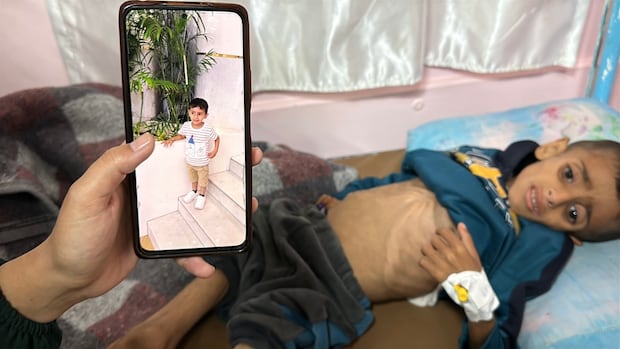 Children face starvation in Gaza as Israel's blockade of food, medication reaches 2 months | CBC News