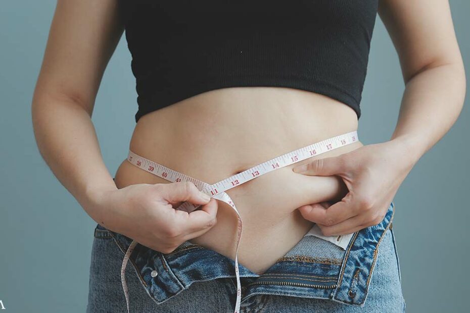 The Impact of Abdominal Fat in Psoriasis