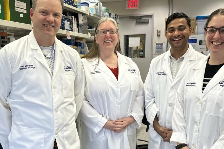 Unseen foundations of brain health: How blood vessel damage may trigger Alzheimer’s disease, Amyo...