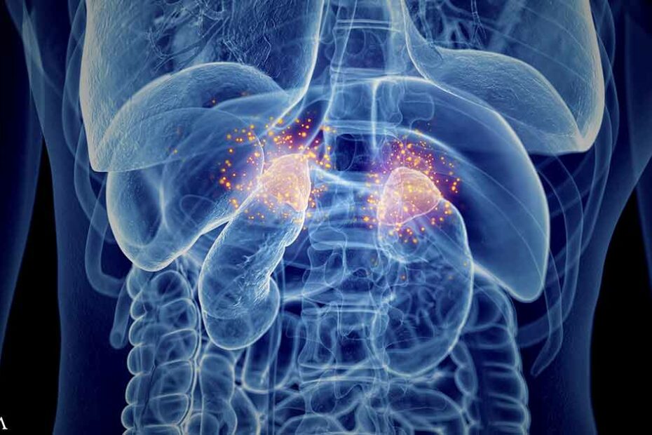 Dispelling the Myth of Adrenal Fatigue