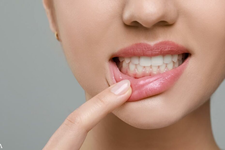 How Your Oral Health Is Linked to Atrial Fibrillation