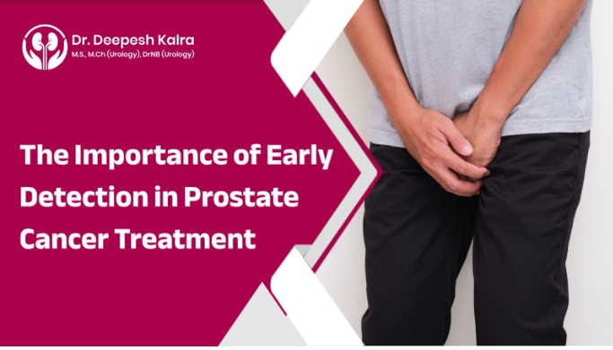 The Importance Of Early Detection In Prostate Cancer Treatment - Unleash Your Lifestyle Potential