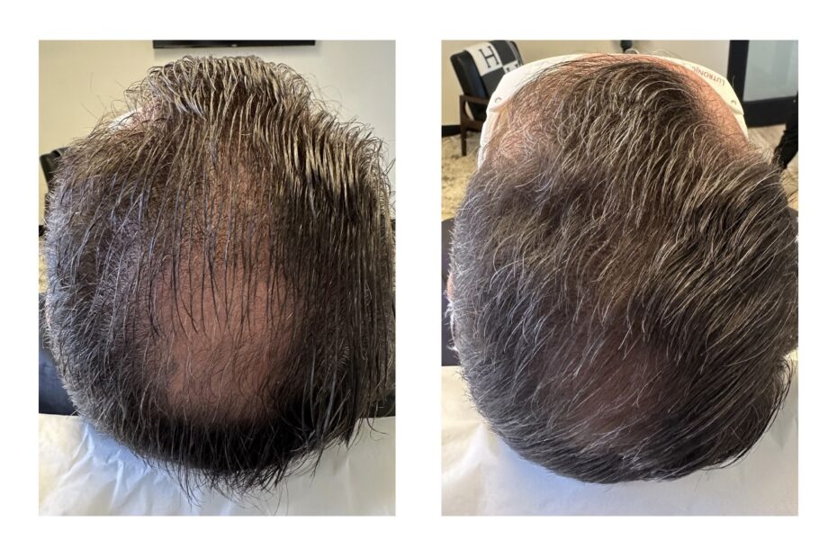 The Science of Scalp Health