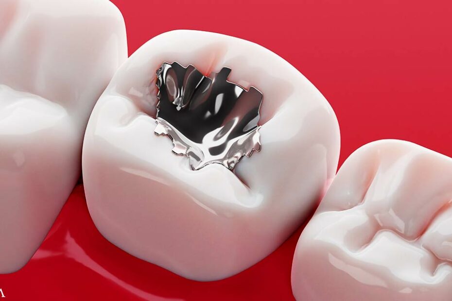 Choice for the Rich, Mercury for the Poor