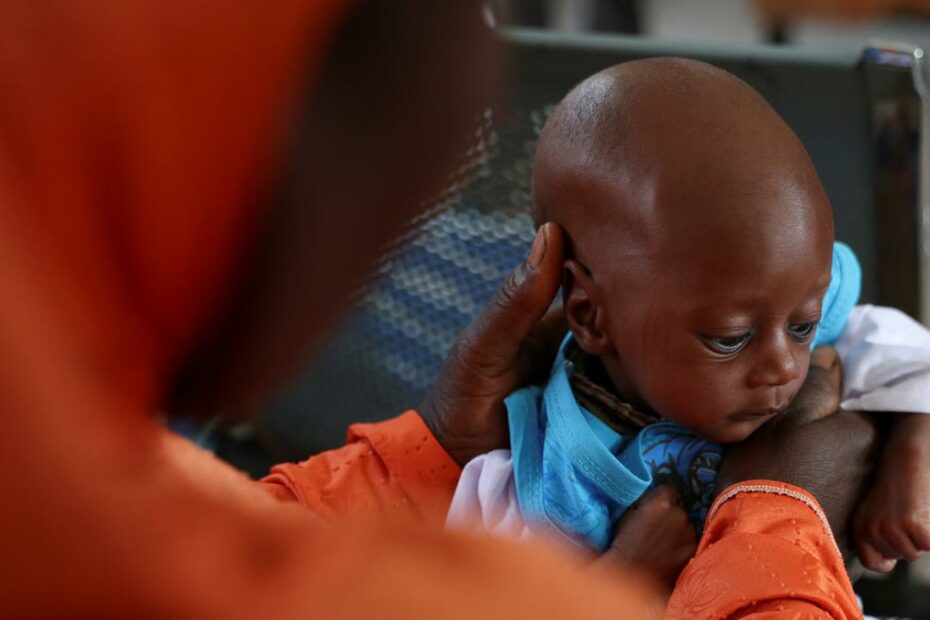 Conflict, poverty, climate change fuel Nigeria’s worsening malnutrition crisis