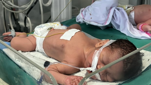 1 week from her due date, Palestinian mother, father killed in Israeli strike. But baby is saved | CBC News