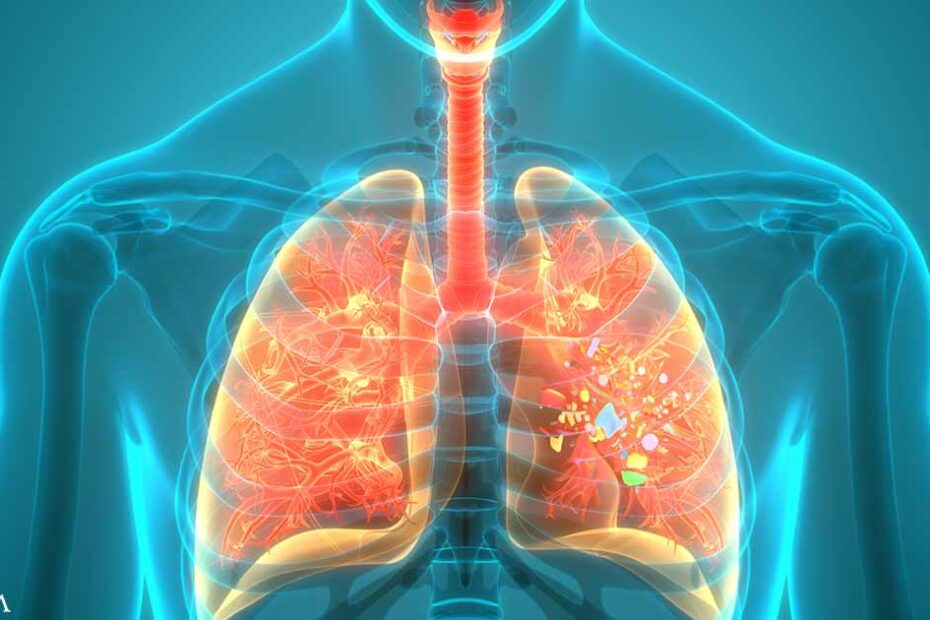 Microplastics Linked to Cancerous Changes in Lung Cells