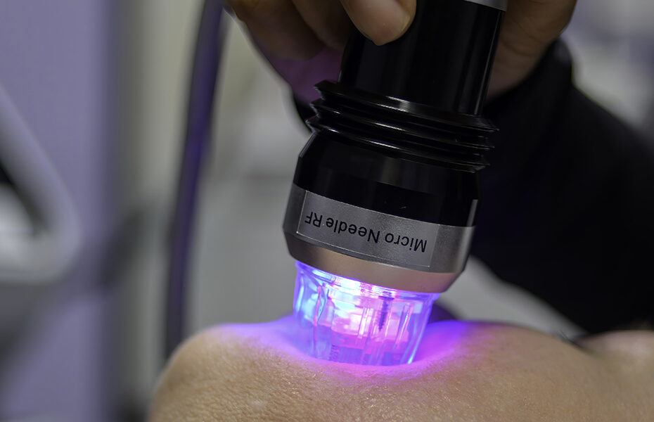 FDA Warning: Complications With RF Microneedling Devices