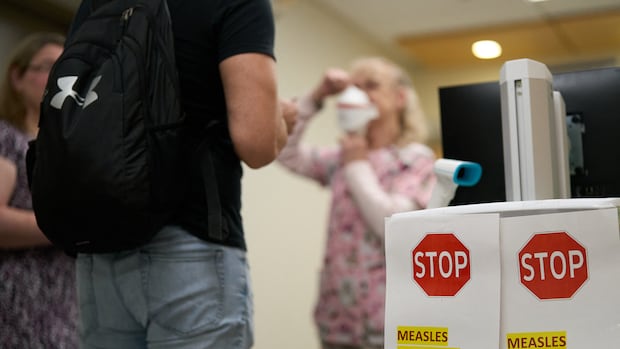 It’s been a year since Canada’s measles outbreak started. What have we learned? | CBC News