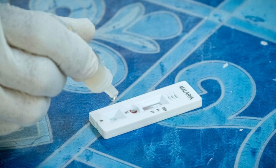 Malaria rapid diagnostic test ‘not fit for purpose’
