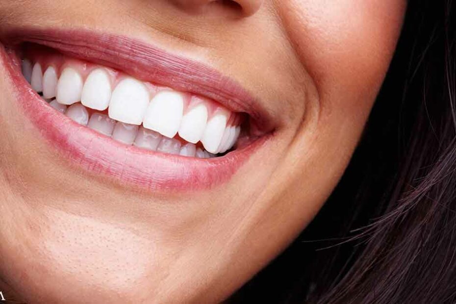 Gum Disease and Cavities Strongly Linked to Higher Stroke Risk