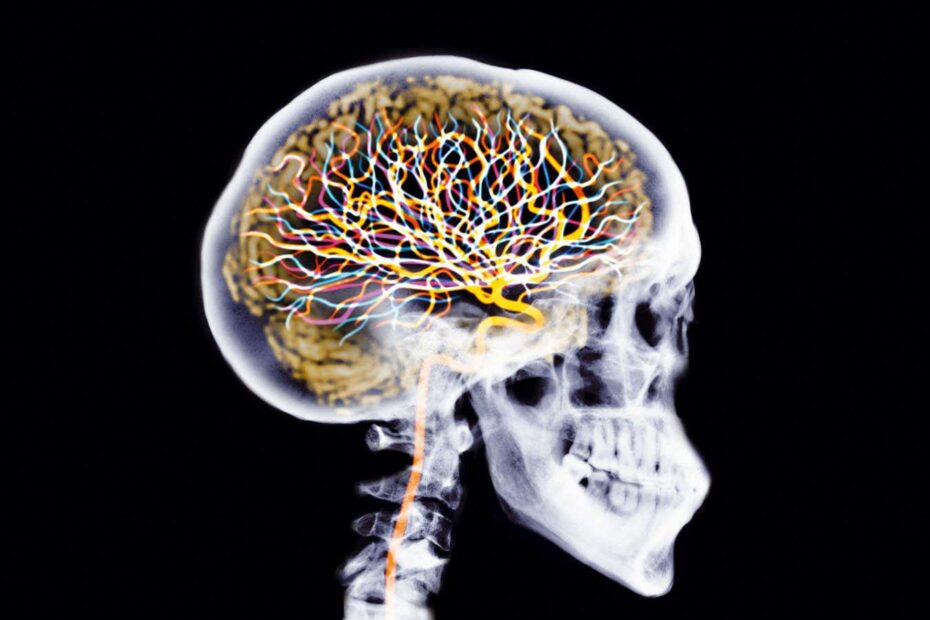 An X-ray skull with coloured brain and neurons